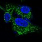 Anti-BDNF Rabbit Monoclonal Antibody